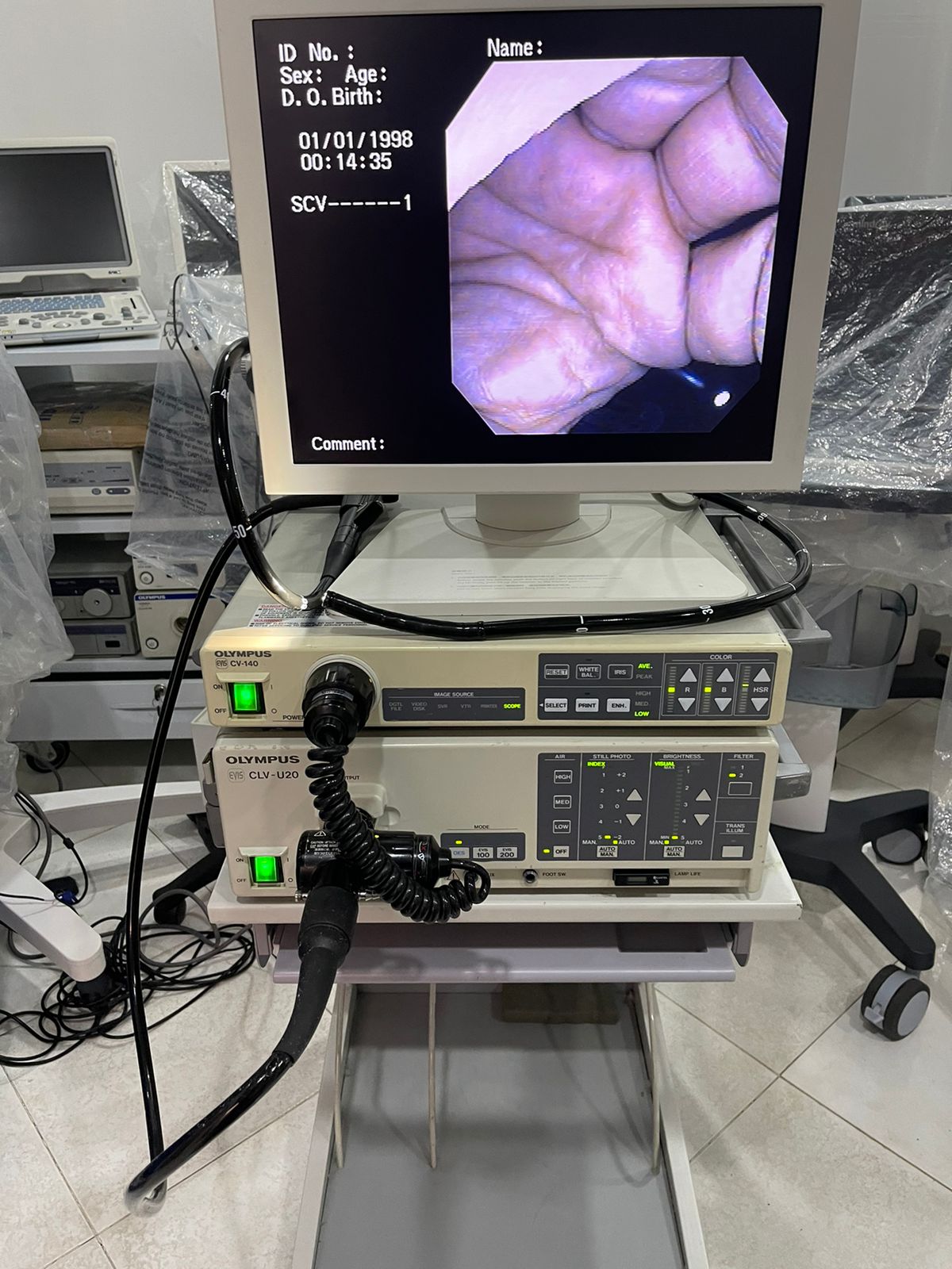 Torre de endoscopia marca Olympus Equipos Médicos de América